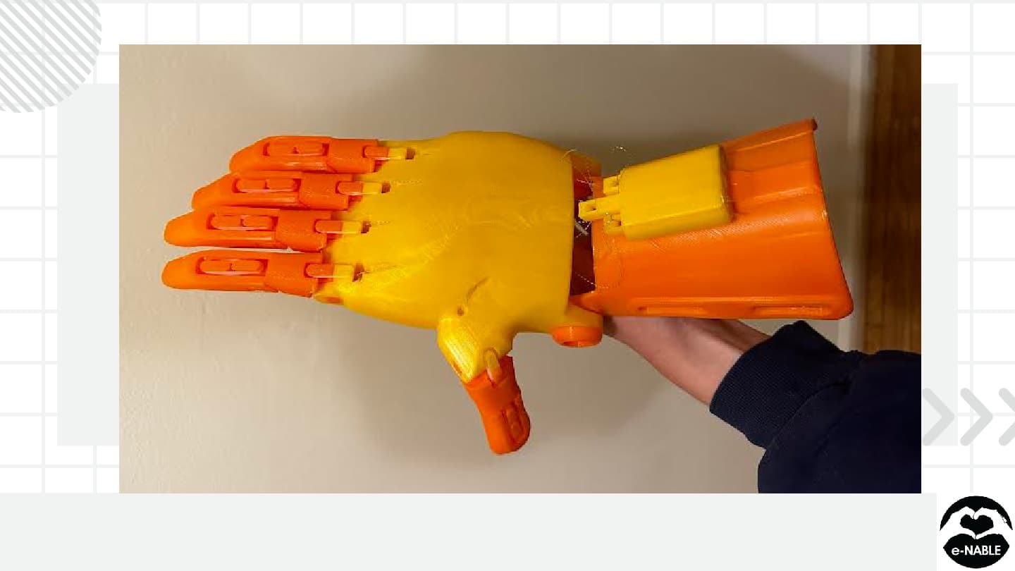 3D printed prosthetic hand designed by E-NABLE UVA team